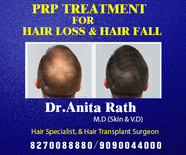 prp for hair loss and hair fall treatment clinic in Bhubaneswar near ayush hospital